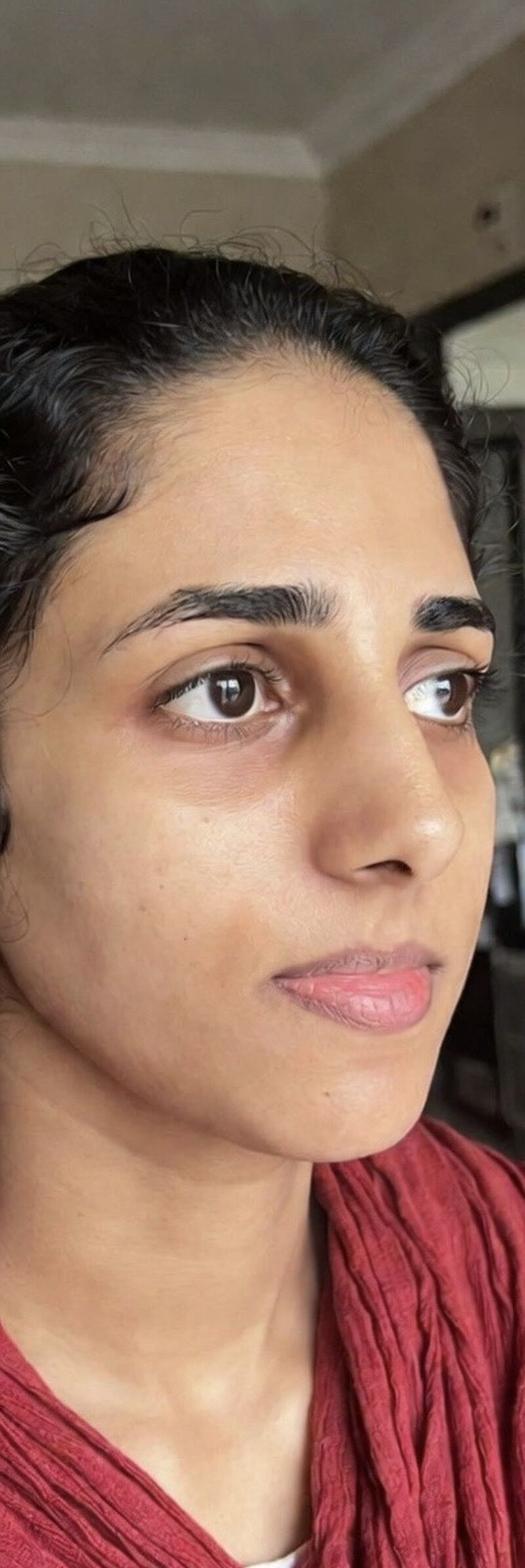Chemical Peels After