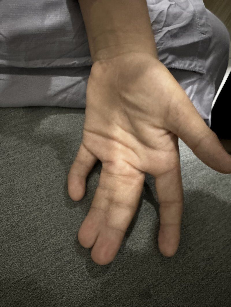 Congenital Deformities Before